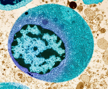 Image: Colored transmission electron micrograph (TEM) of a thyroid cancer cell (photo courtesy Steve Gschmeissner / Science Photo Library).